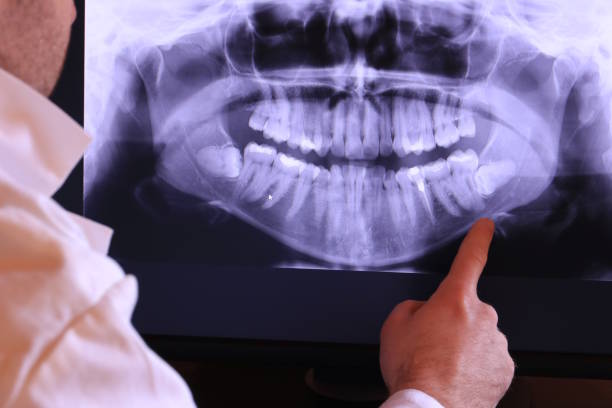 Best Orthodontic Emergency Dentist in Franconia, VA
