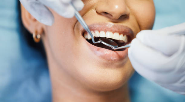 Best Pediatric Emergency Dentist in Franconia, VA